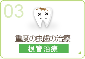 重度の虫歯の治療