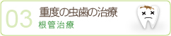 重度の虫歯の治療