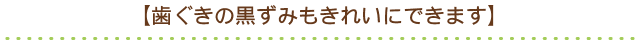 【歯ぐきの黒ずみもきれいにできます】